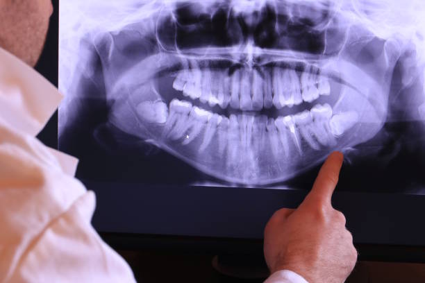 Best Mobile Emergency Dentist in Rhome, TX